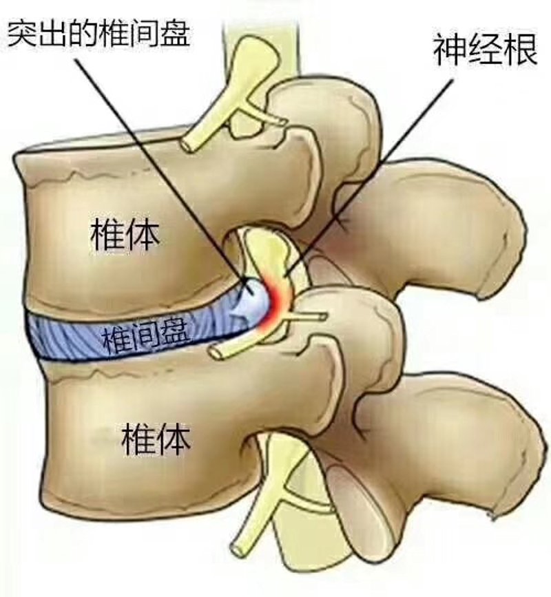 如何选择最适合你的理疗机构——以“赵氏骨科”为例