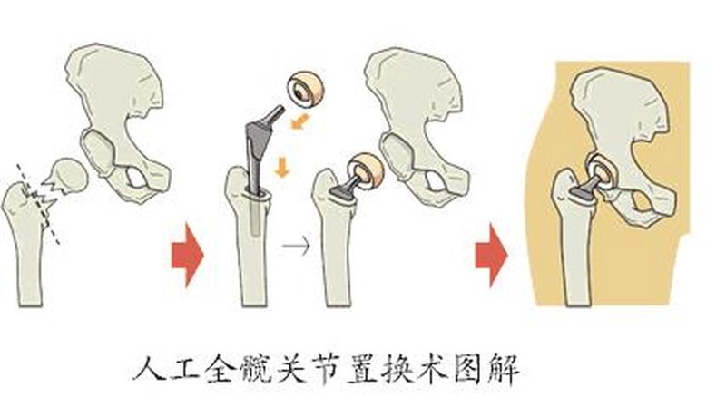 骨伤科诊所如何在竞争中脱颖而出？——故事化叙述带你了解