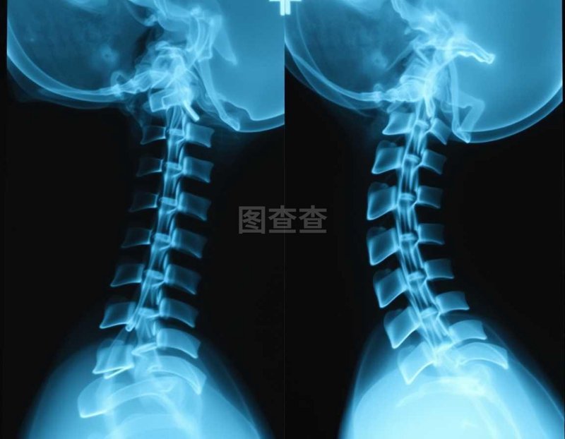 在选择开设一家骨伤科诊所前，您可能会面临诸多考量。这篇文章将从多个维度对比分析传统中医骨伤科诊所与现代西医骨伤科诊所的不同之处，帮助您做出明智的决策。